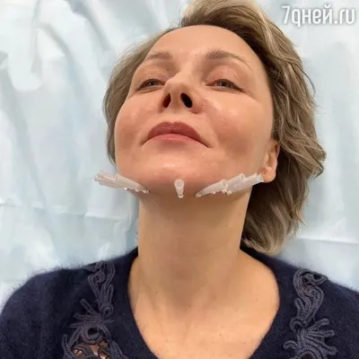 Дарья Повереннова показала шокирующее фото из кабинета косметолога