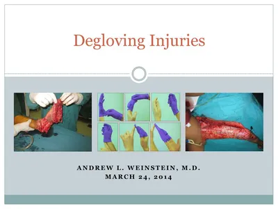 PPT - Degloving Injuries PowerPoint Presentation, free download - ID:6337287