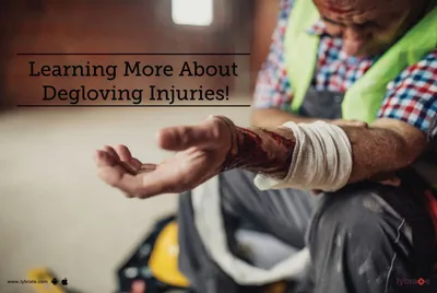 Learning More About Degloving Injuries! - By Dr. Mohd Zeeshan Hakim |  Lybrate