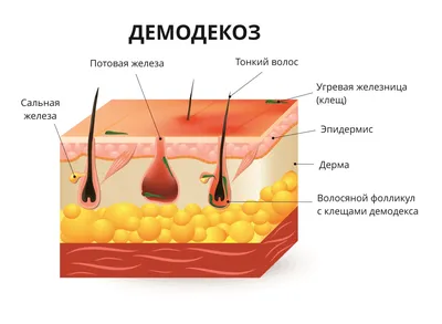 Демодекоз на лице, веках, голове, ресницах - лечение, симптомы, признаки