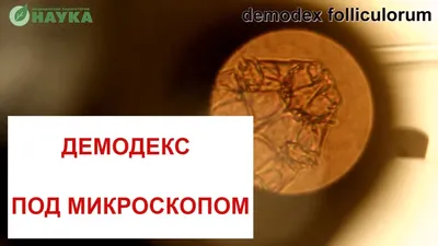 Подкожный клещ Демодекс под микроскопом 🙈🔬 Demodex Follicles Фото + Видео  - YouTube