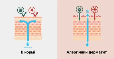 ᐈ Как выглядит аллергический дерматит? ~【Аллергопробы в Киеве】