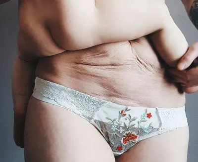 Отвисшая кожа, диастаз – это часть меня». В «Инстаграме» запустили флешмоб  о том, как выглядит женское тело после родов - CityDog.io