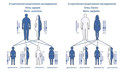 Прогрессирующая мышечная дистрофия Дюшенна - случай из практики – тема  научной статьи по клинической медицине читайте бесплатно текст  научно-исследовательской работы в электронной библиотеке КиберЛенинка