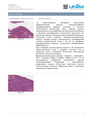 Рак кожи: симптомы, как выглядит, признаки, виды, фото и лечение -  belhope.ru