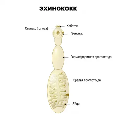 Эхинококкоз: как избежать послеоперационных рецидивов + аудио