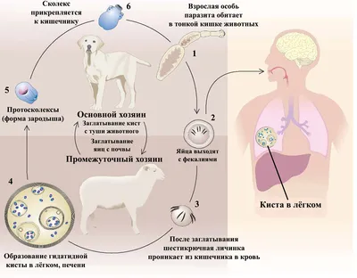 4.3. Эхинококковые поражения лёгких и средостения