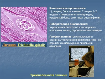 Инвазионные заболевания печени с/х животных