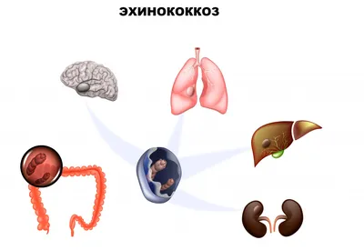 ПАТОМОРФОЛОГИЧЕСКИЕ ИССЛЕДОВАНИЯ ПЕЧЕНИ ЖИВОТНЫХ ПРИ ПАРАЗИТИРОВАНИИ  ПУЗЫРЧАТОЙ ФОРМЫ ОДНОКАМЕРНОГО ЭХИНОКОККА