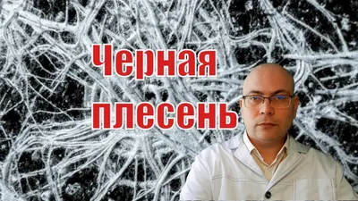 Экзема на лице, руках и ногах - причины и лечение атопического дерматита -  YouTube