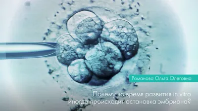 Почему во время развития in vitro иногда происходит остановка эмбриона? -  Reprolife Київ