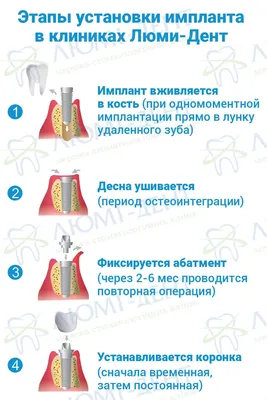 Astra Tech Зубные Импланты [Цена Киев] 179 Отзывов- ЛюмиДент