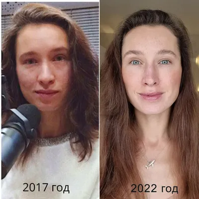 Как я изменилась за месяц благодаря массажу и тейпированию лица. Фото до и  после - Рамблер/новости