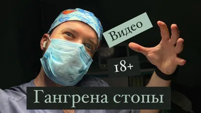 Гангрена стопы. Первые признаки. Влажная? Gangrene. Сахарный диабет. -  YouTube