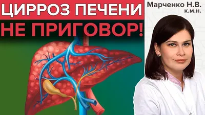 ВОССТАНОВЛЕНИЕ ПЕЧЕНИ | Помощь печени в домашних условиях - YouTube