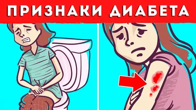 Первые Признаки Болезни Печени! - YouTube