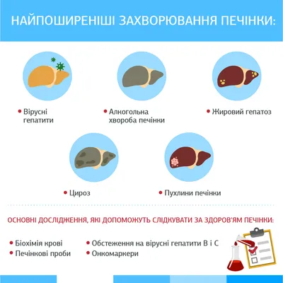 Болезни печени: симптомы, признаки, диагностика, лечение - медицинская  лаборатория ДИЛА