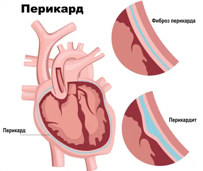 Врачи назвали признаки заболевания сердечных клапанов, среди которых —  одышка (Eat This, Not That, США) | 10.01.2023, ИноСМИ