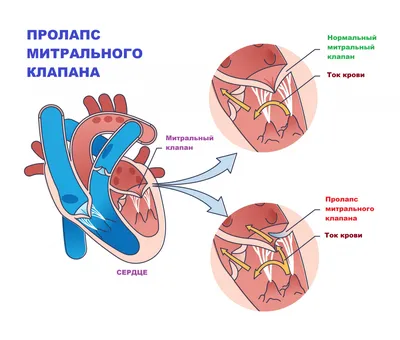 Сердечная недостаточность - симптомы, что это такое, как понять что она у  тебя, признаки