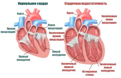 Анатомия для студентов медицинских ВУЗов (часть 2: Анатомия сердца) | Good  doctor | Дзен