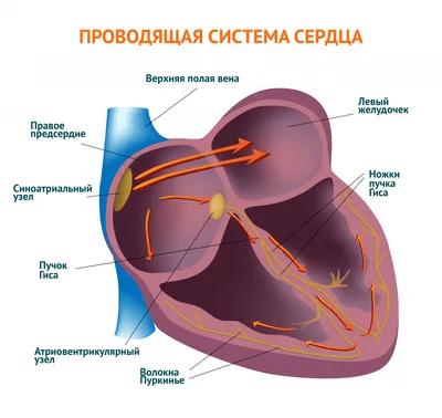 Болезни системы кровообращения