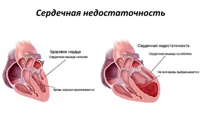 Сердечно-сосудистая система и что в нее входит