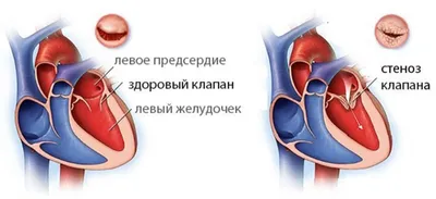 Мышечная система человека - полезная информация о мышцах