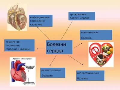 Безопасное протезирование и пластика клапанов сердца | Киев