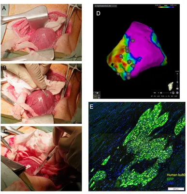 Sterile Pericarditis in Aachener Minipigs As a Model for Atrial Myopathy  and Atrial Fibrillation | Protocol (Translated to Russian)