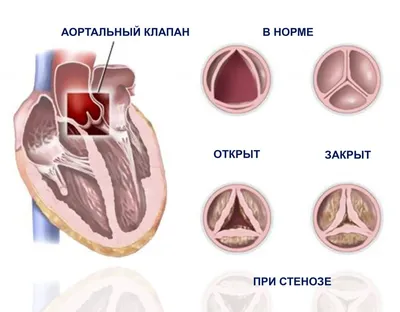 Ощутима ли выгода от покупки свинины живым весом?