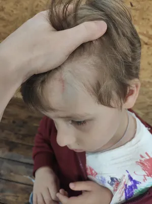 Перелом ключицы и гематома: в одном из гипермаркетов Киева на ребенка упал  шкаф | Новини