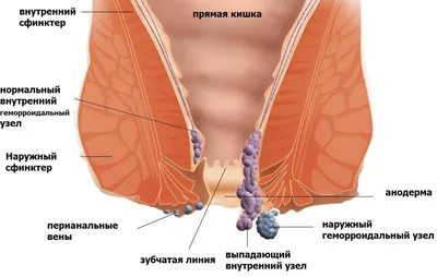 Лечение геморроя в клинике в Челябинске - Клиника «Вся Медицина»
