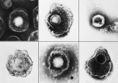 Герпесвирусы — Википедия