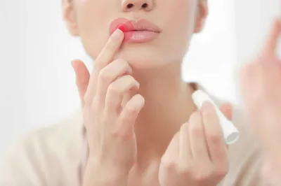 Герпес на губах: причины, симптомы, лечение