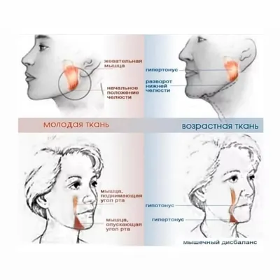 О нижней трети лица | Возрастные изменения, их коррекция