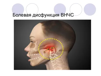 Мышцы лица. Значение тонуса мышц.. Статьи от Академии - ТТ