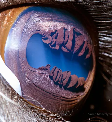 Глаз верблюда - 60 фото