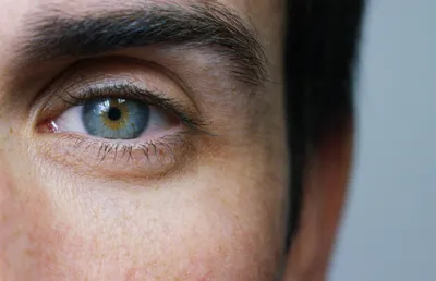 Синдром сухого глаза: симптомы, причины, лечение | РБК Стиль