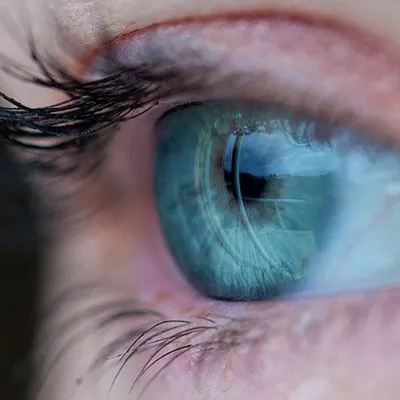 Впервые в мире: британцу пересадили глаз, напечатанный на 3D-принтере -  26.11.2021, Sputnik Казахстан