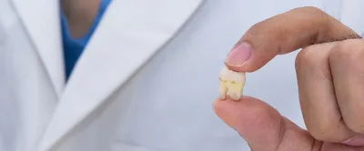 Удаление зуба - цена в 32Dent :: Сложное удаление зуба в Киеве