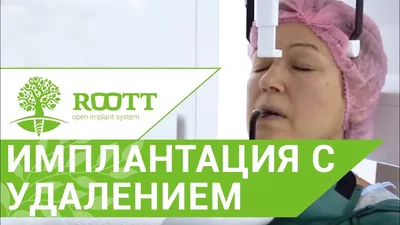 Удаление корня зуба: цена и особенности операции в стоматологии — ROOTT