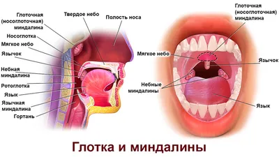 Ангина у взрослых: лечение, симптомы, отличия