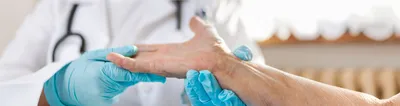 Грибок ногтей на руках | Эффективное лечение грибка на пальцах рук в Москве  ✓ Клиника подологии Полёт