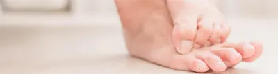 Грибок на ногах: эффективное лечение грибка ногтей на пальцах ног в Москве  ✓ Клиника подологии Полёт