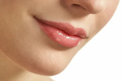 Увеличение губ гиалуроновой кислотой в центре Перми в клинике Мировая  косметология