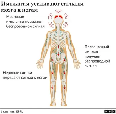 Импланты под кожу. Процесс нанесения, время заживления и противопоказания.