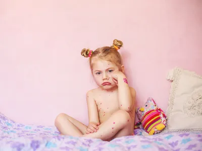 Сыпь у ребенка: причины появления сыпи на детской коже и способы ее  лечения. Как уменьшить зуд при сыпи | WOMAN