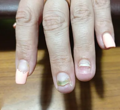 Ногти после снятия гель лака - 41 фото