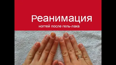 Как восстановить ногти после гель лака - 90 фото реконструкции ногтевой  пластины