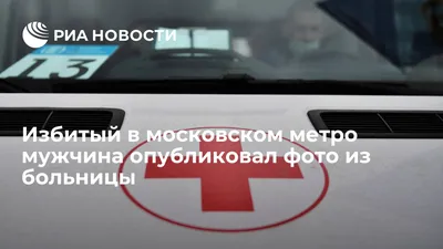 Избитый в московском метро мужчина опубликовал фото из больницы - РИА  Новости, 07.10.2021